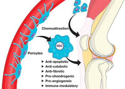 Mesenchymal Stem Cell Therapy for Osteoarthritis: The Critical Role of the Cell Secretome